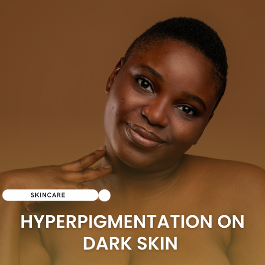 Hyperpigmentation On Darker Skin Types