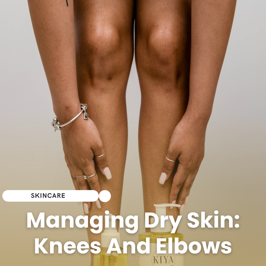 Managing Dry Skin: Knees And Elbows